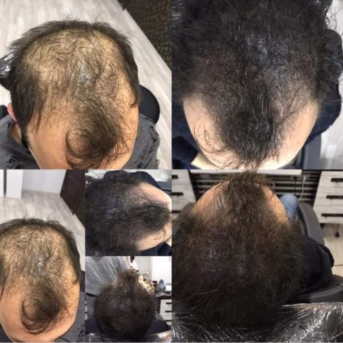 adana-sac-simülasyonu-kaliteli-adana